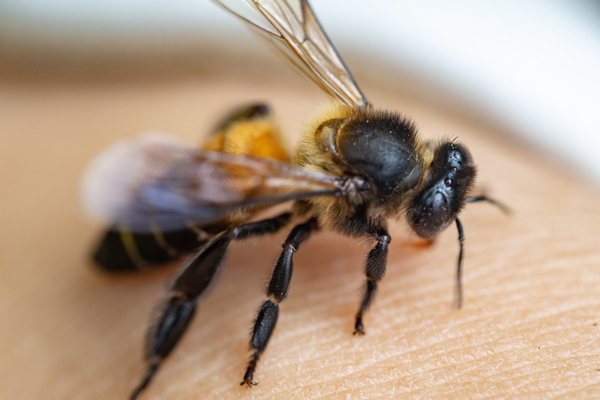 Что делать если Вас ужалила пчела