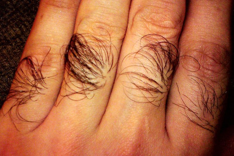 Почему растут волосы на пальцах