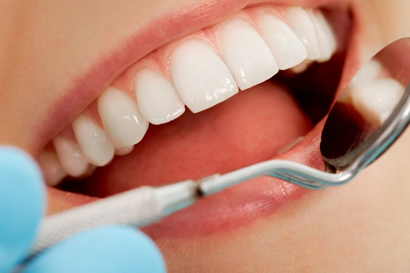 8 вопросов к ортодонту