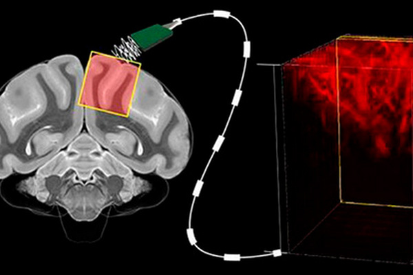 Учёные стали ближе к «чтению мыслей» без хирургического вмешательства в мозг
