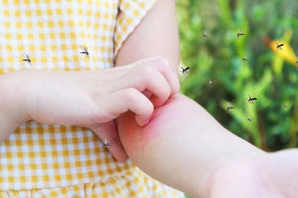 Что делать, если ребенка покусали комары или мошки: первая помощь