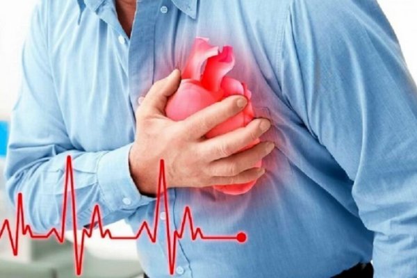 Как выявить инфаркт и что делать при сердечном приступе – советы Минздрава