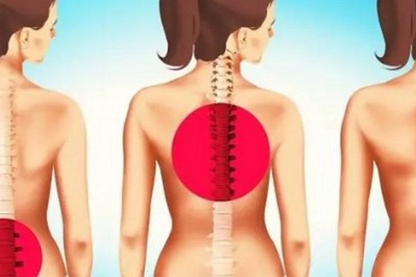 Почему болит спина: самые частые жалобы