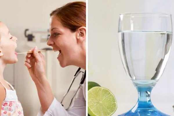 Соленая вода и лимон: как избавиться от боли в горле при отсутствии лекарства