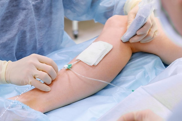 Лазерная коагуляция вен: когда проводиться процедура и в чем ее эффект