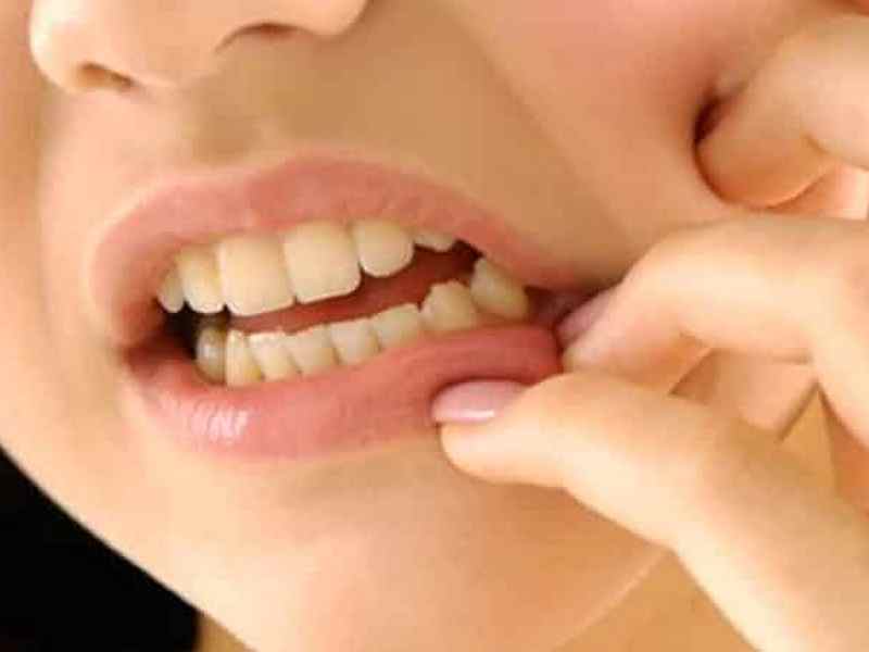 Учёные научились лечить зубы без пломб