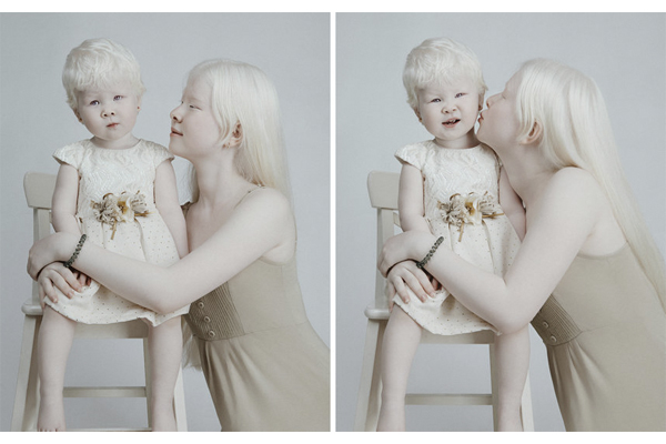 Сестры-альбиносы очаровали мир своей красотой: захватывающие фотографии, которые поразят каждого